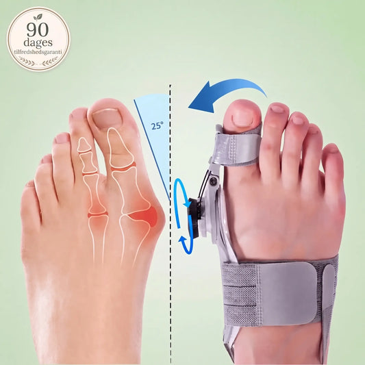 TåKorrekt™ – Skånsom justering og smertelindring ved hallux valgus