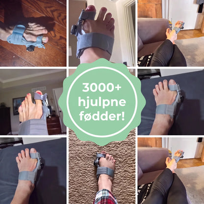 TåKorrekt™ – Skånsom justering og smertelindring ved hallux valgus
